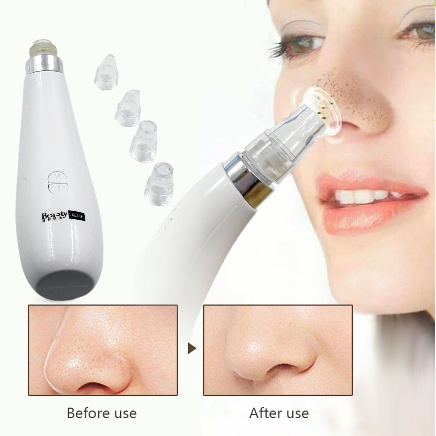 0351A Blackhead Remover Vacuum Suction Facial Pore Cleaner Dermabrasion Face Facial Pore Cleaner, Beauty Device kit with 4 Suction Probes for Women & Men 0351A Blackhead Remover Vacuum Suction Facial Pore Cleaner Dermabrasion Face Facial Pore Cleaner, Beauty Device kit with 4 Suction Probes for Women & Men